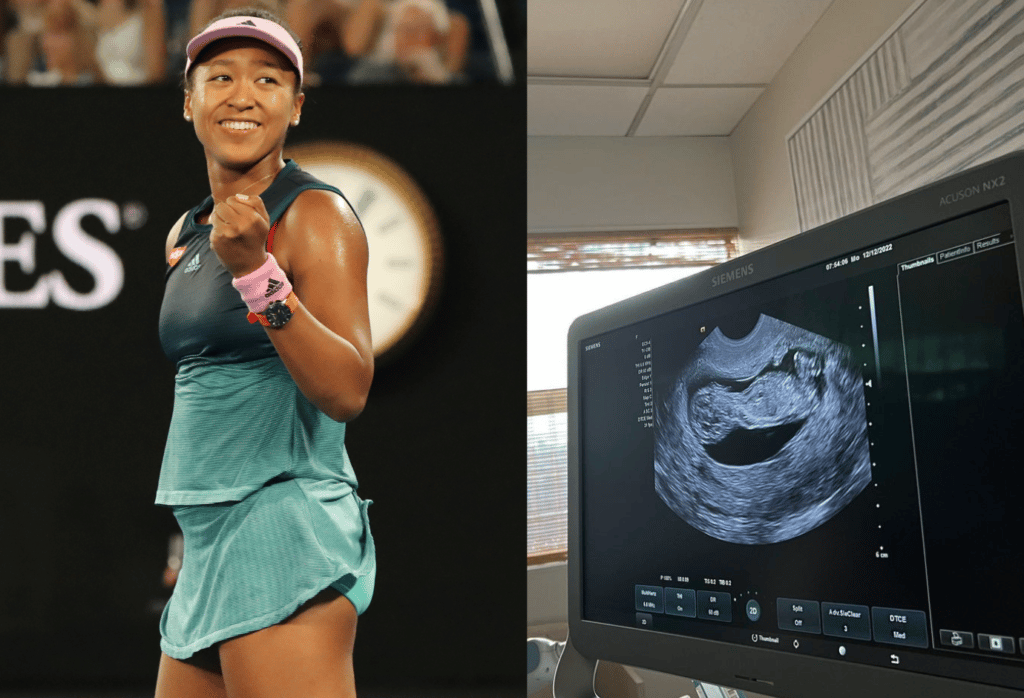 Tennis star Naomi Osaka announces she's pregnant with a girl