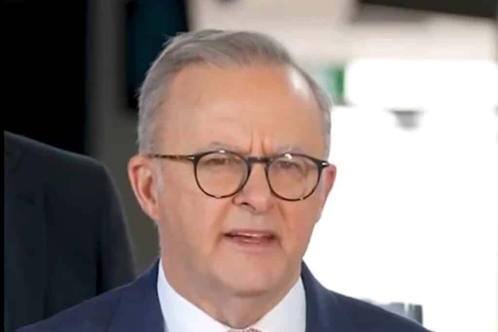 Anthony Albanese