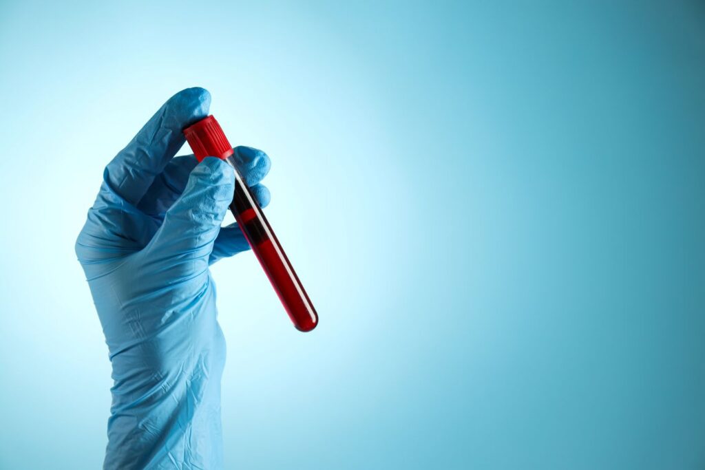 Blood test