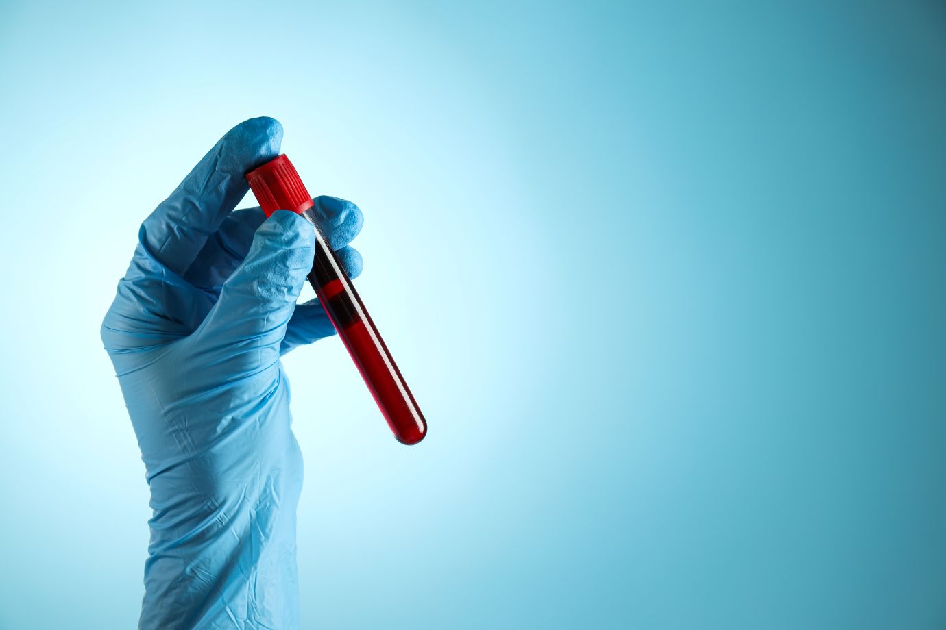 New Alzheimer’s blood test could transform care for hundreds of thousands of Australian women at risk