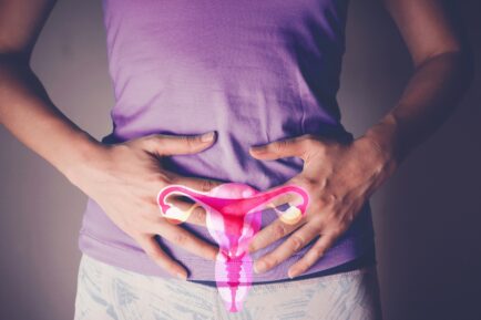 PCOS